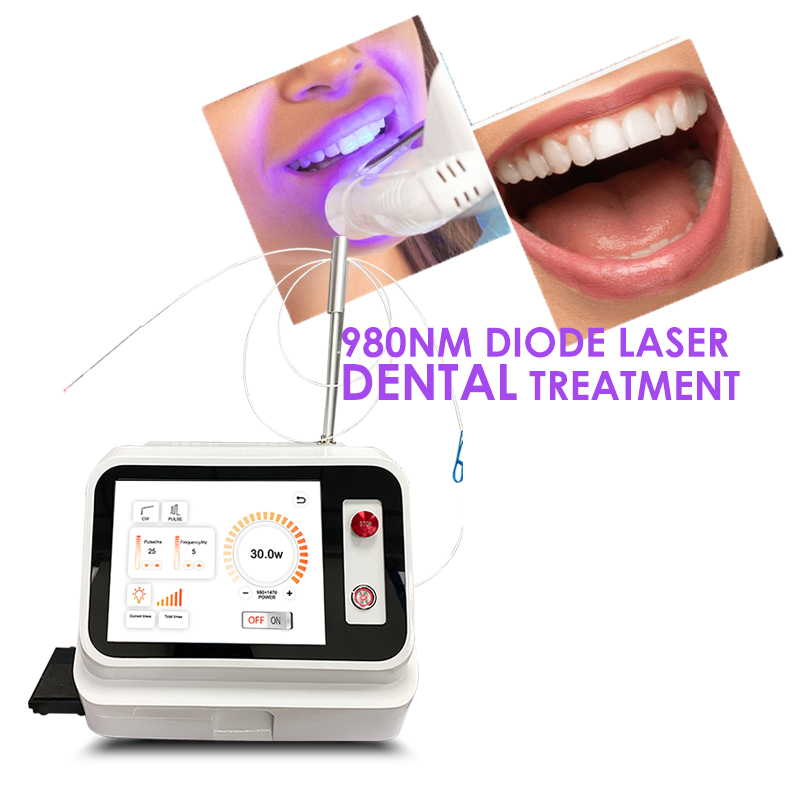 Teeth Whitening With Laser - เครื่องเลเซอร์สำหรับเนื้อเยื่ออ่อนทางทันตกรรม รุ่นขายดีปี 2024 เลเซอร์ไดโอด 980 นาโนเมตร