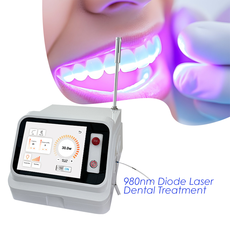 เครื่องเลเซอร์สำหรับเนื้อเยื่อ - Teeth Whitening With Laser บทวิจารณ์และราคา