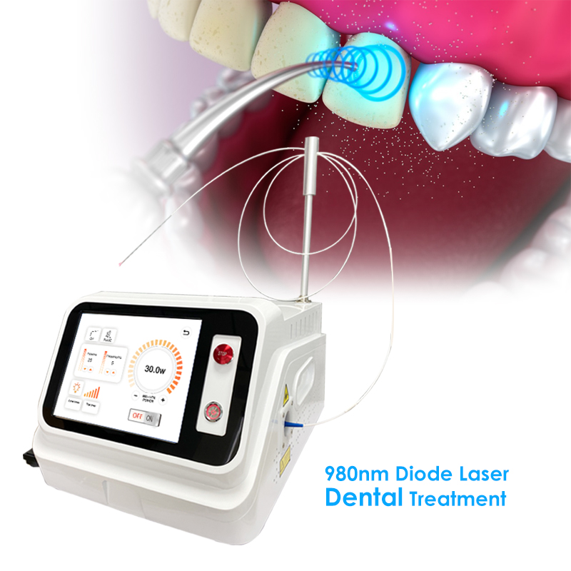 เครื่องเลเซอร์สำหรับเนื้อเยื่อ - Teeth Whitening With Laser บทวิจารณ์และราคา