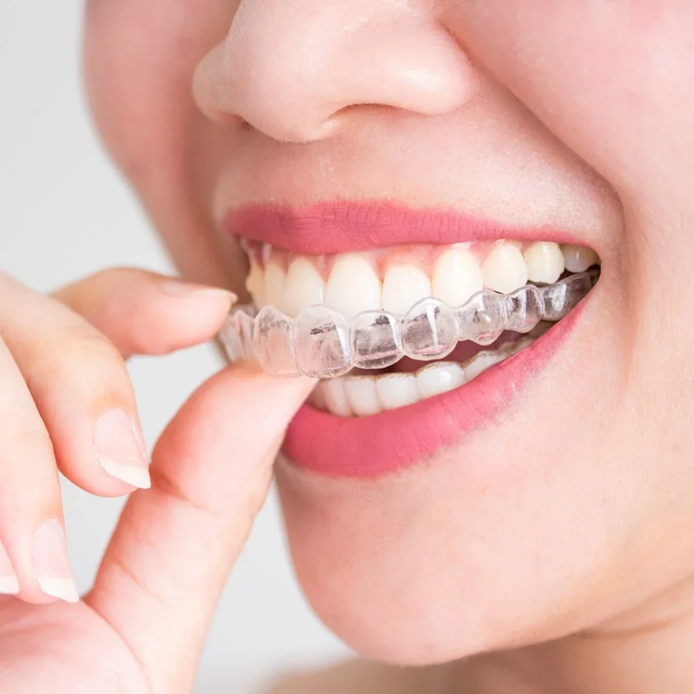 1-4 ชิ้น อุปกรณ์ป้องกันการกรนแ - Teeth Whitening Mouth Guard บทวิจารณ์และราคา
