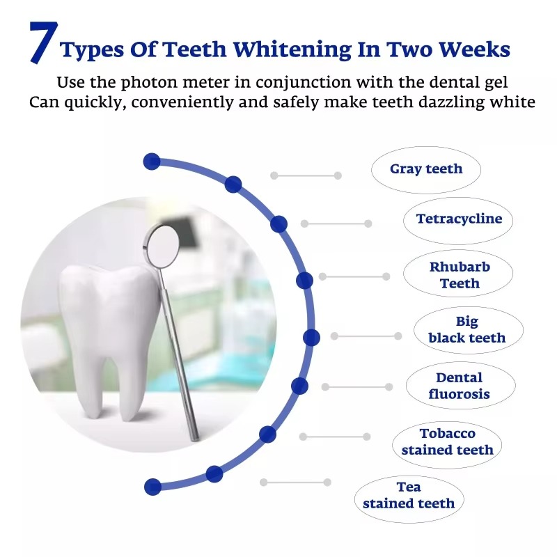 อุปกรณ์ชาร์จแบบพกพา USB/iPhone - Teeth Whitening For Trays บทวิจารณ์และราคา