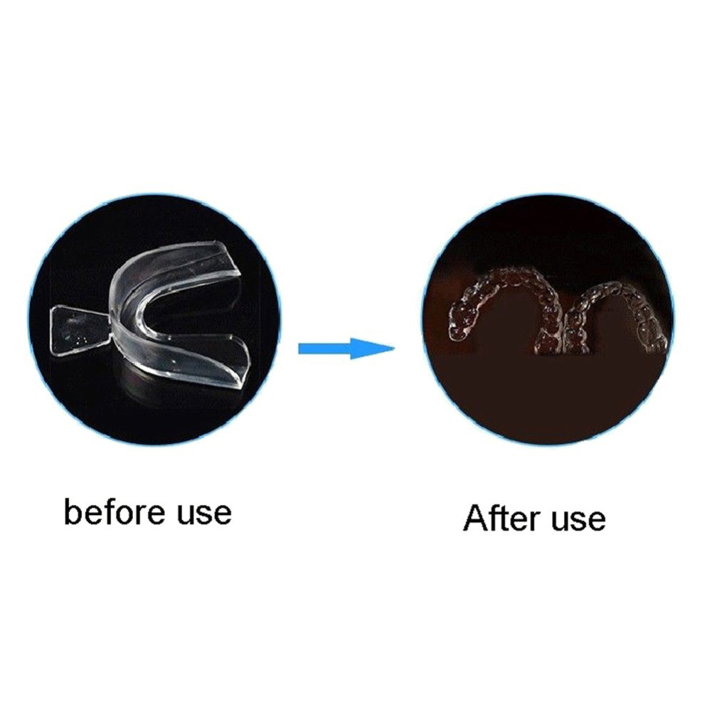ชุดอุปกรณ์จัดฟันแบบนุ่ม 2/4 ชิ - Teeth Whitening Mouth Guard บทวิจารณ์และราคา