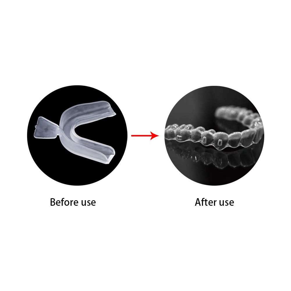 อุปกรณ์ป้องกันฟันกัด ป้องกันกา - Teeth Whitening Mouth Guard บทวิจารณ์และราคา